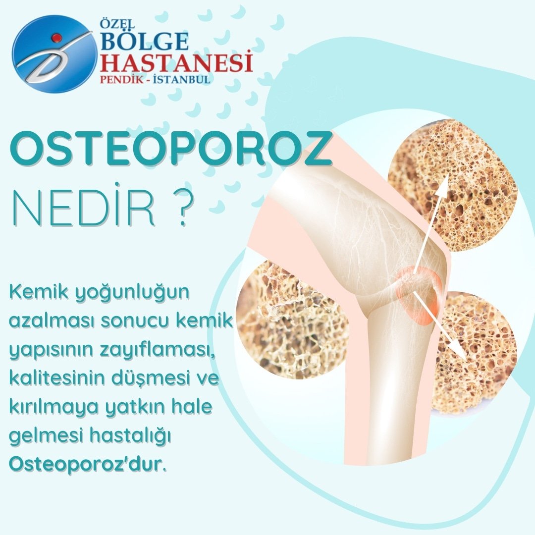 Osteoporozun önemli bir sağlık sorunu olması nedeni eşlik ettiği kırıklardır. 65 yaş ve üzeri kişilere kemik yoğunluğu ölçümü yaptırmayı ihmal etmeyin.

Randevu ve daha fazla bilgi için :
📞 444 1 455
🌐 bolgehastanesi.com

#pendikbölgehastanesi #osteoporoz #kemikerimesi