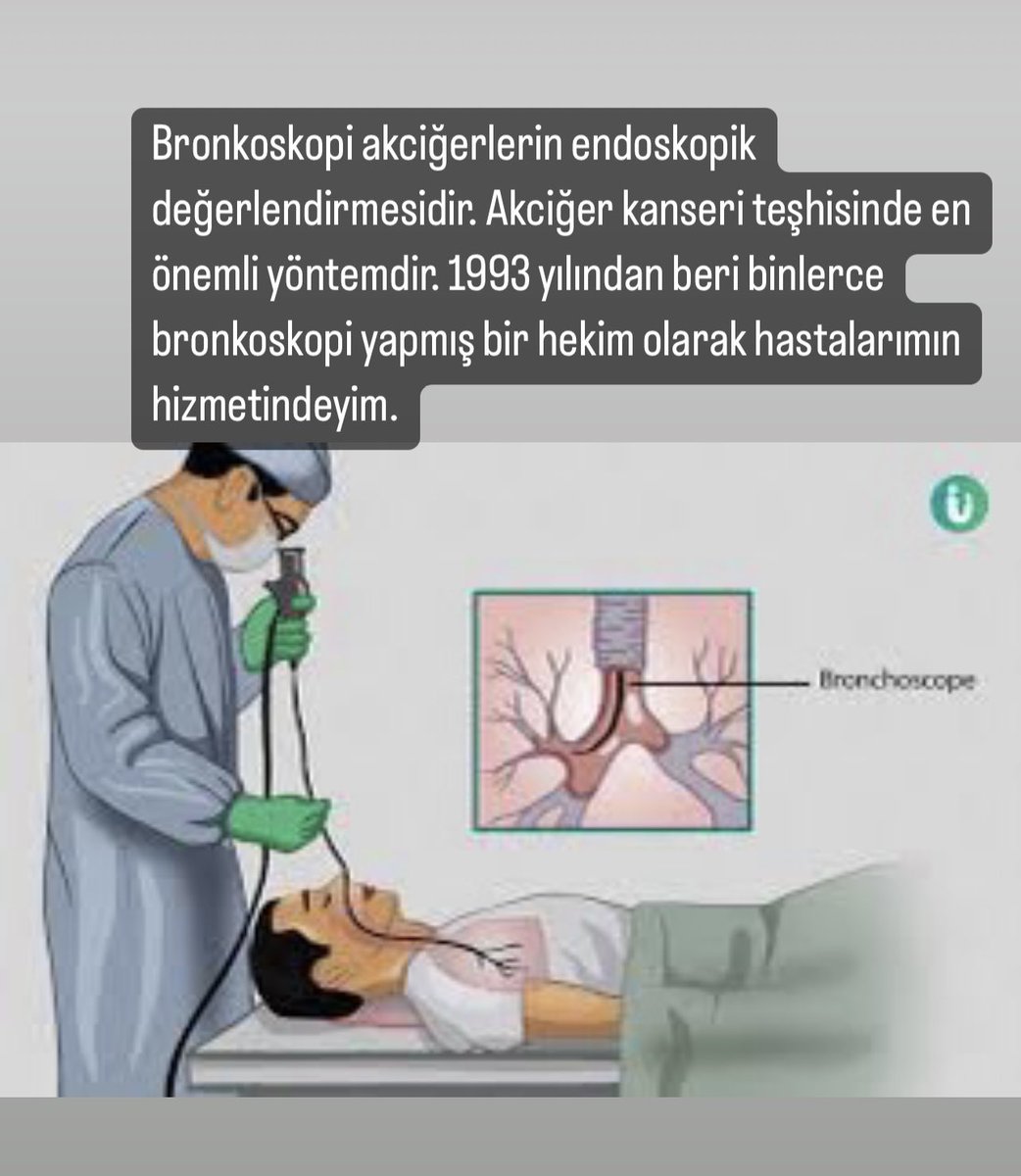 ProfSFindik's tweet photo. #bronkoskopi #akciğer #biopsi #kanser #akciğerkanseri #teşhis https://t.co/OuBFRjuaVg