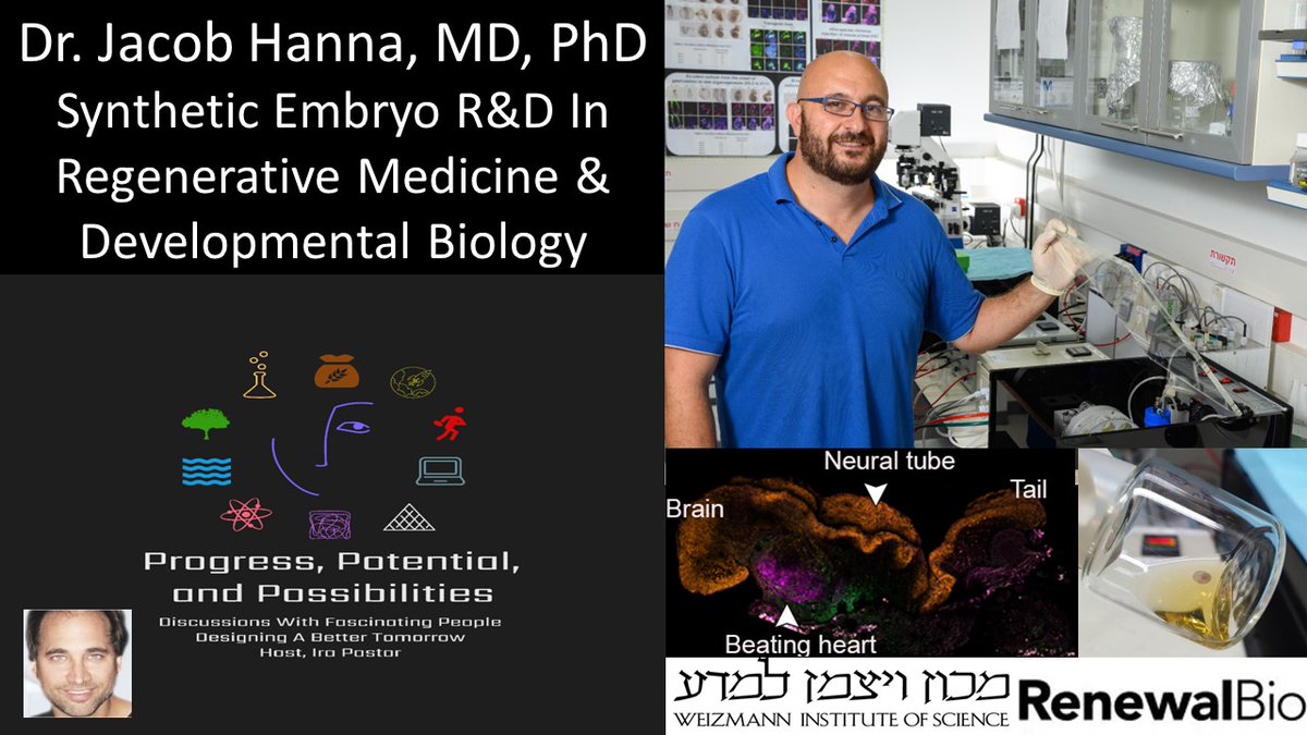 Progress, Potential, And Possibilities (@progresspotent1) on Twitter photo Synthetic Embryo R&D In Regenerative Medicine & Developmental Biology - Dr. <a href="/jacob_hanna/">Jacob (Yaqub) Hanna - يعقوب حنا</a> MD, Ph.D. <a href="/WeizmannScience/">Weizmann Institute</a> <a href="/ProgressPotent1/">Progress, Potential, And Possibilities</a> #Embryology #Embryo #StemCells #CellReprogramming #Cloning #ArtificialWombs #RegenerativeMedicine #Health #Aging #Longevity youtube.com/watch?v=EQGxSj… Synthetic Embryo R&D In Regenerative Medicine & Developmental Biology - Dr. <a href="/jacob_hanna/">Jacob (Yaqub) Hanna - يعقوب حنا</a> MD, Ph.D. <a href="/WeizmannScience/">Weizmann Institute</a> <a href="/ProgressPotent1/">Progress, Potential, And Possibilities</a> #Embryology #Embryo #StemCells #CellReprogramming #Cloning #ArtificialWombs #RegenerativeMedicine #Health #Aging #Longevity youtube.com/watch?v=EQGxSj…