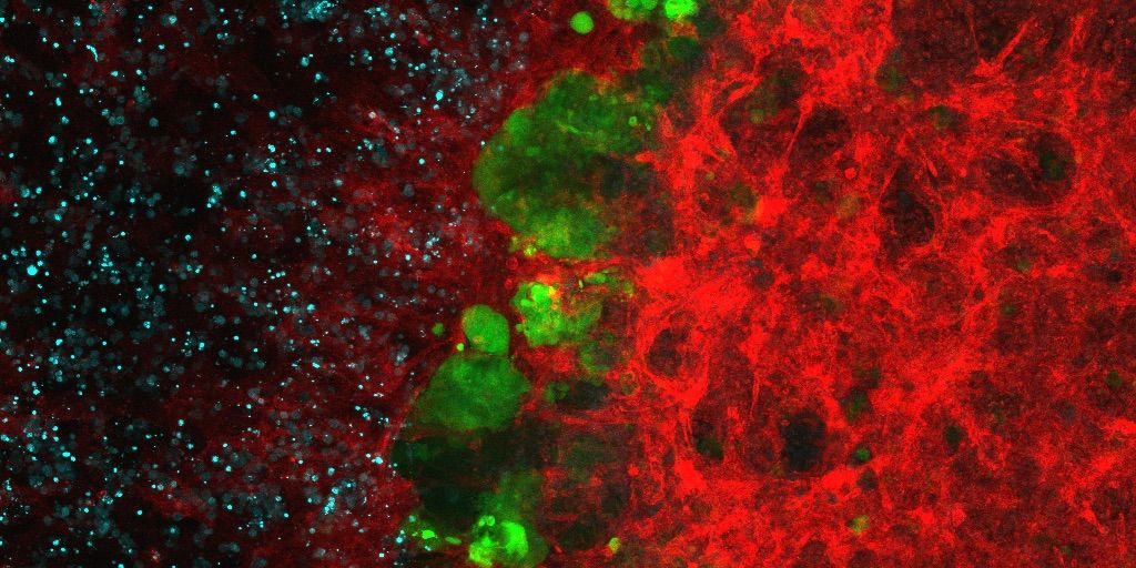 IRBBarcelona's tweet photo. 🍁We are happy to start November with this amazing #ImageOfTheMonth of the #IRBBarcelona calendar!

🧫"Organoid Universe", shows an organoid used to study metastasis in colon cancer.

📸by Maria Salvany, Ana Henriques and Doris Logtenberg from the Colorectal Cancer Lab @BatlleLab https://t.co/YUg1Bn9XeM