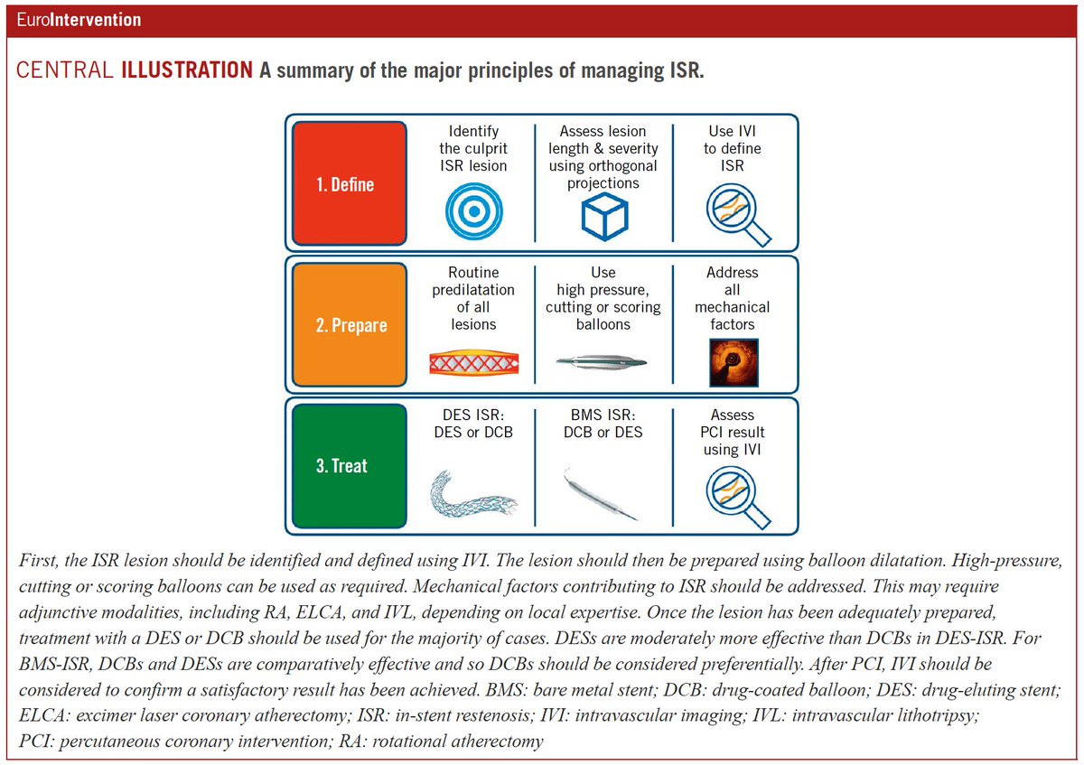 MANAGEMENT OF IN-STENT RESTENOSIS: this State-of-the-Art review comprehensively discusses current evidence-based strategies for the management of ISR in contemporary interventional practice. #EIJBestOf #EAPCI @robebyrne #Cardiotwitter ow.ly/1mku50LrGhH