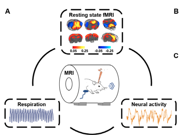 interesting new paper by Tu et al. <a href="/NanyinZhang/">Nanyin Zhang</a> - respiratory-locked dynamics in fMRI are often thought to reflect noise, but they show a neural origin for respiratory-linked signals!  elifesciences.org/articles/81555