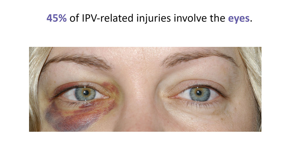 Review the etiology of #ocular and #orbital #trauma with this new course on intimate partner violence (IPV). Learn how to save both #vision and lives with appropriate screening, management and referral. A free benefit for Academy members. ow.ly/xxOY50Lm2WI