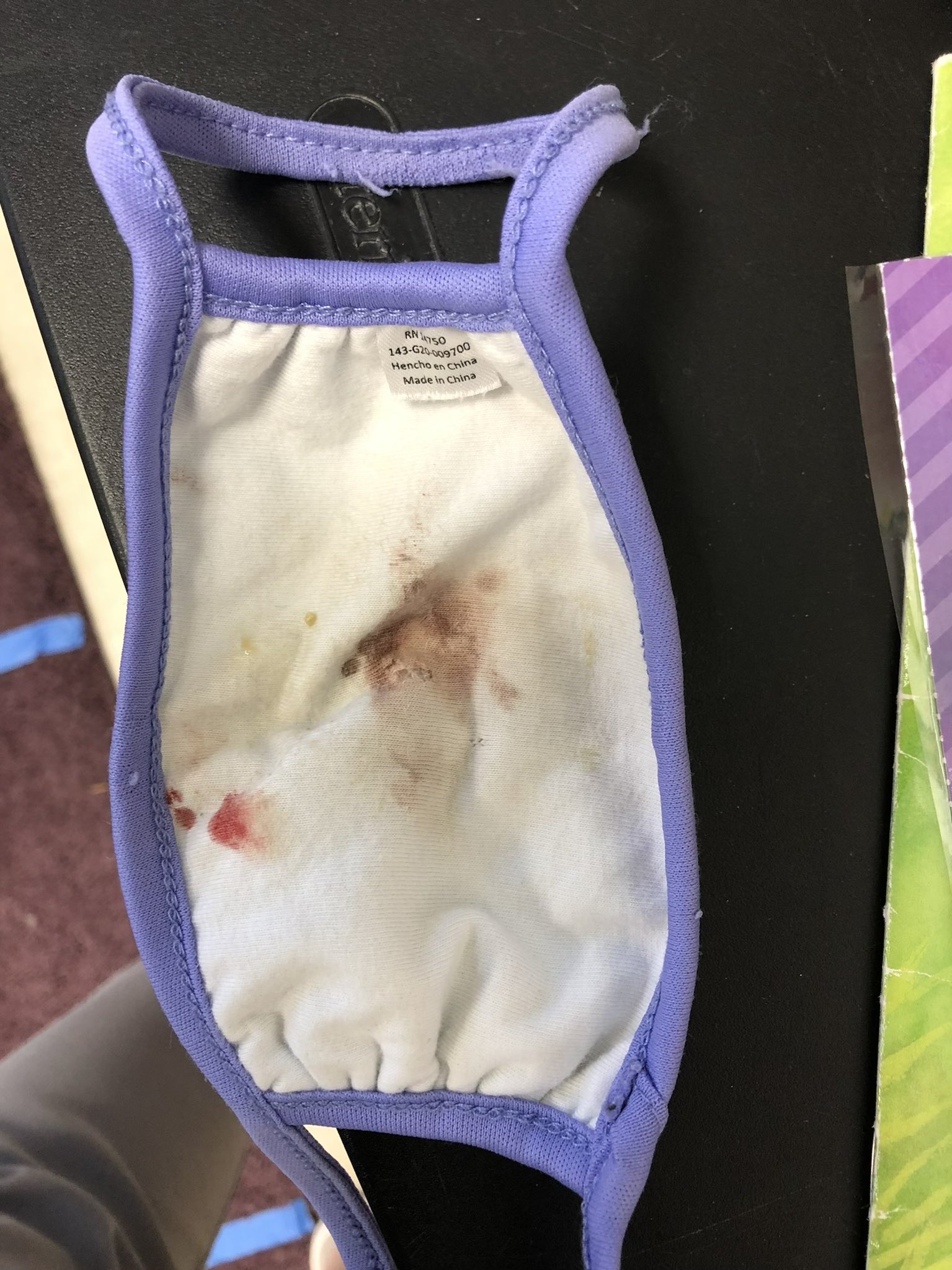 What Does Amniotic Fluid Look Like On Underwear