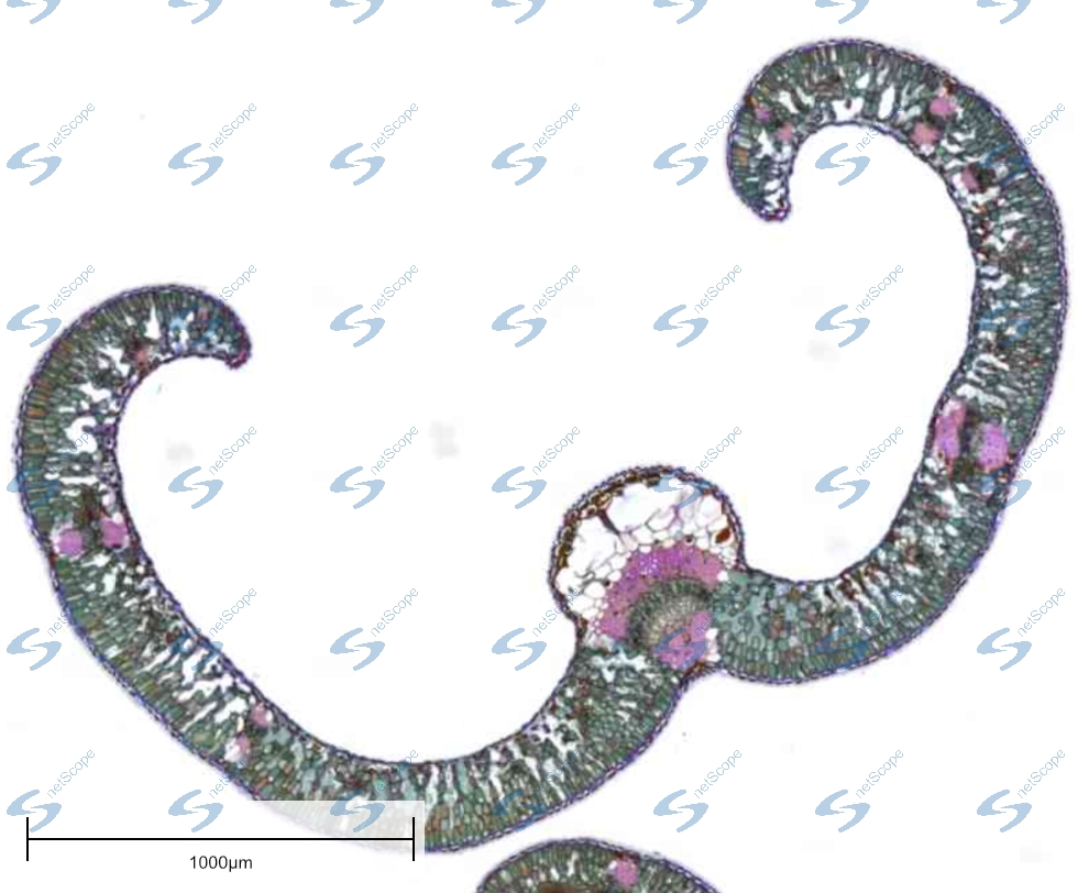We just released version 1.10 of #netScope Viewer.
netscope.de/?tw

New features
* #DICOM support
* Adding #watermark to snapshots
* Updated #mrxs support (SlideAC update required)
* Speed up of the start
* Fixed bugs on #Aperio #SVS slides