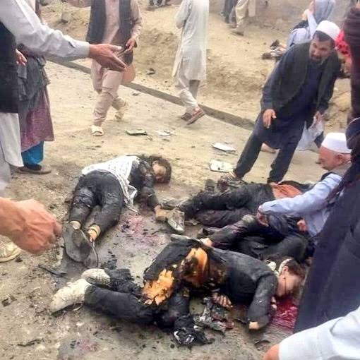 Hasanrezahazara's tweet photo. بعد از انفجار خواستم دست اش را بگیرم متوجه شدم دستان اش نیست😥
#StopHazaraGenocide 
#BanTaliban https://t.co/Kb1wPrPAe7