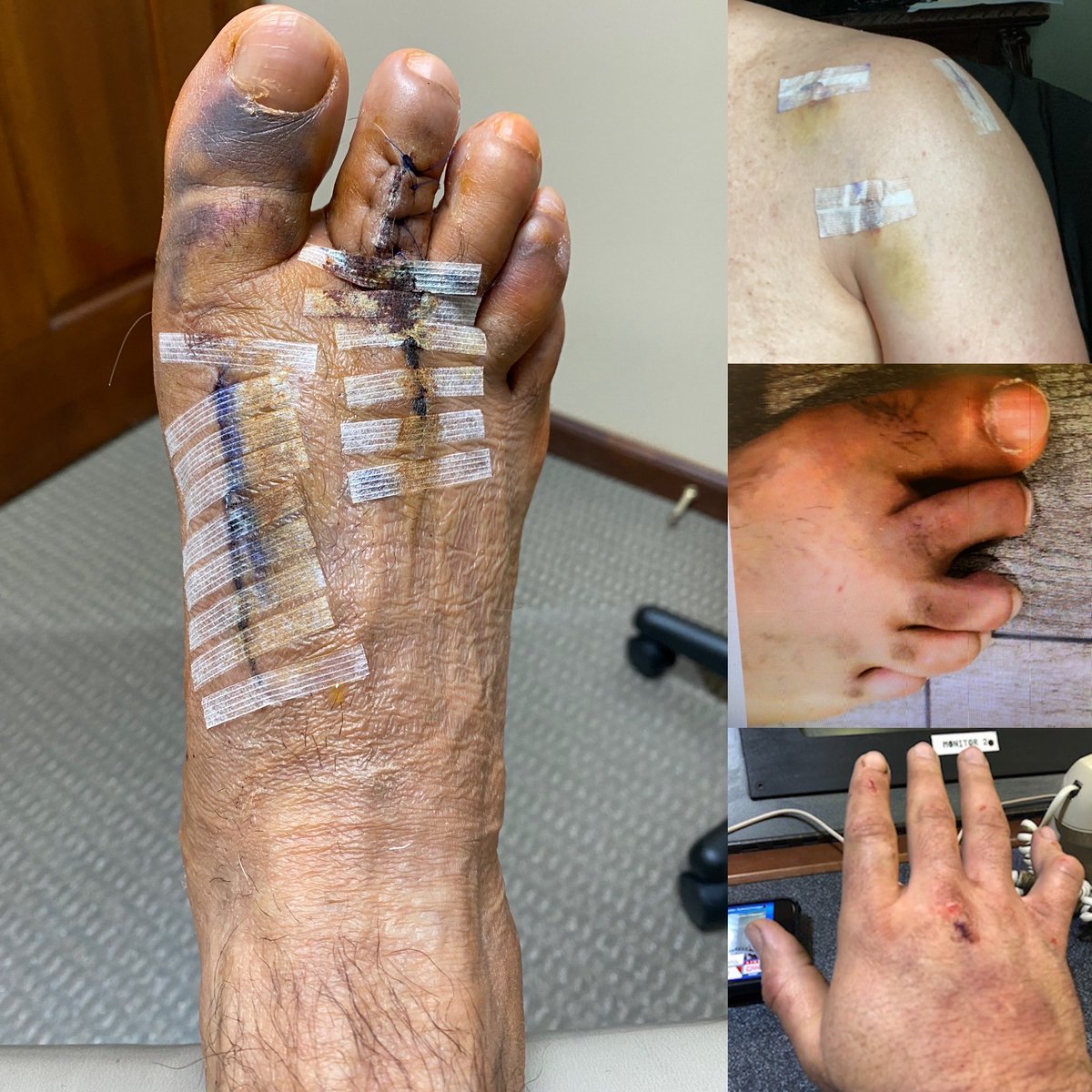 As you make your choice on who to vote, remember one party advocated for an insurrection/a coup and condone political violence in their attempt to violate the US Constitution in their quest to hold power. This is what they did to me in my attempt to protect everyone in Capitol.