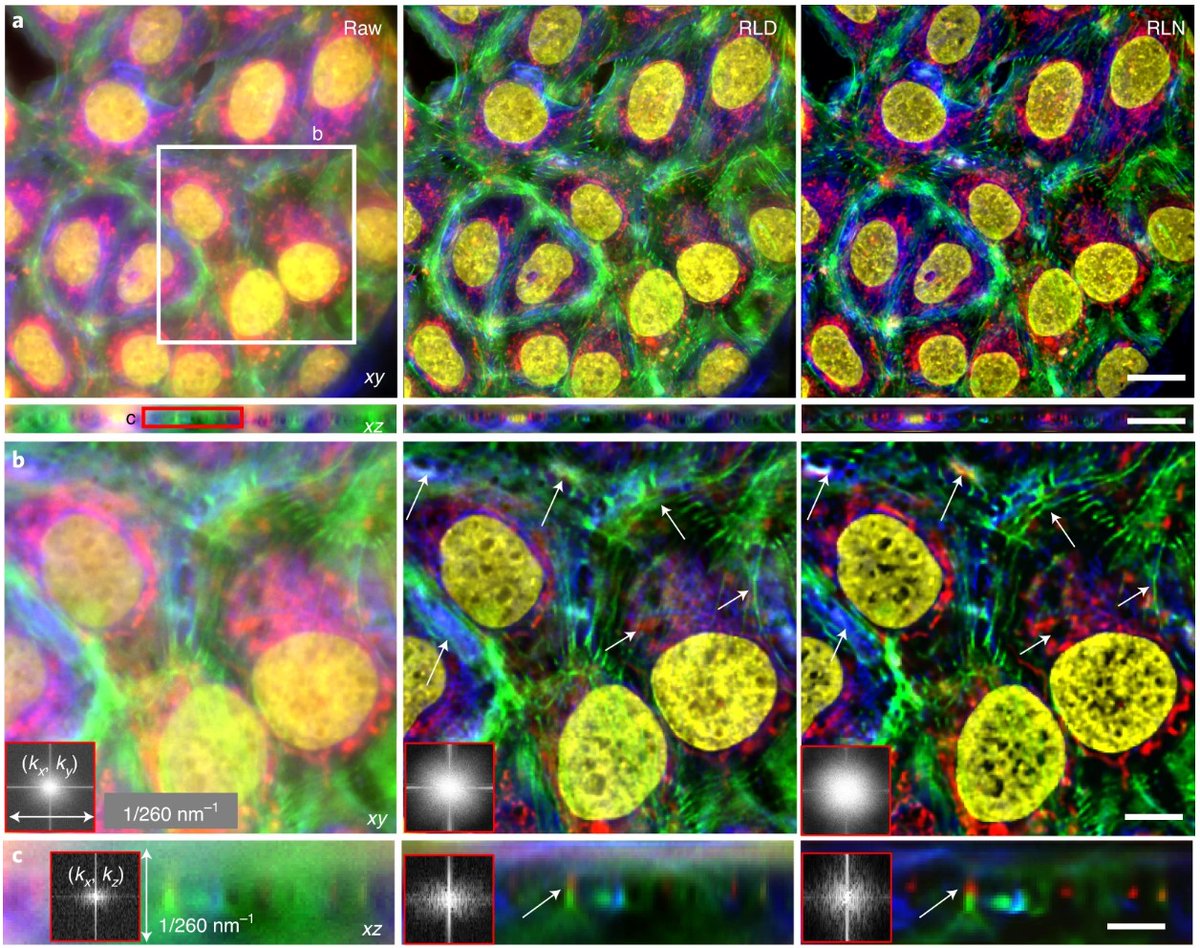 HHMI | Janelia (@hhmijanelia) on Twitter photo A new paper <a href="/naturemethods/">Nature Methods</a> from the Shroff Lab details a new & improved method for processing 3D fluorescence microscopy images that incorporates info about the image formation process into a deep learning network. (1/10)
nature.com/articles/s4159… A new paper <a href="/naturemethods/">Nature Methods</a> from the Shroff Lab details a new & improved method for processing 3D fluorescence microscopy images that incorporates info about the image formation process into a deep learning network. (1/10)
nature.com/articles/s4159…