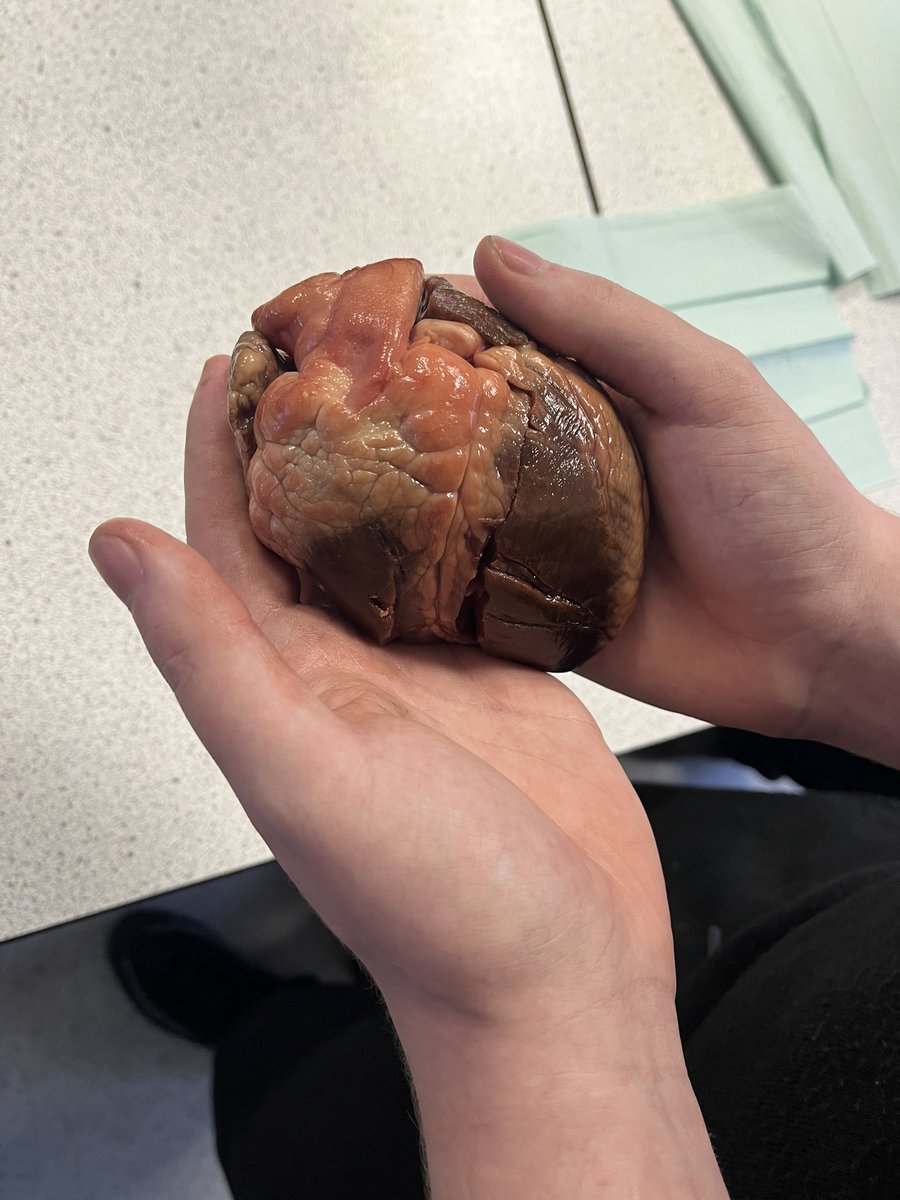 BA_Science1's tweet photo. S3 pupils learning about the impacts of Space travel on the heart! ❤️🚀 https://t.co/Yde5LDAyVA