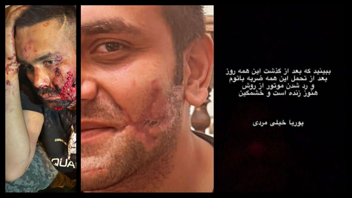 حرومزاده‌ها! من هنوز زنده‌ام!

«این فیلمی که نازی آباد یکی رو میزنن و با موتور از روش رد میشن دوست ما پوریاست. فیلم برای ۴۰ روز پیشه. با موتور از روش رد شدن دستش شکست. با تیر به صورتش زدن، صورتش پاره شد. چهل روز بیمارستان بود. الان مرخص شده و زنده‌ست.»