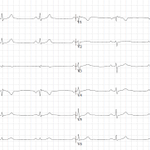 Photo by ECG Cases (@ecg_cases)