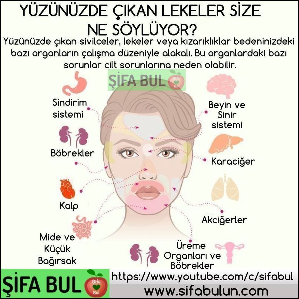 SifaBul's tweet image. YÜZÜNÜZDE ÇIKAN LEKELER SİZE NE SÖYLÜYOR? #şifabul #şifabul #sivilceler #yüzdekilekeler #yüzharitası #sağlık #sağlıkbilgileri #sağlıkhaberleri #sağlıklıyaşam #şifalıbitkiler #doğaltedaviler