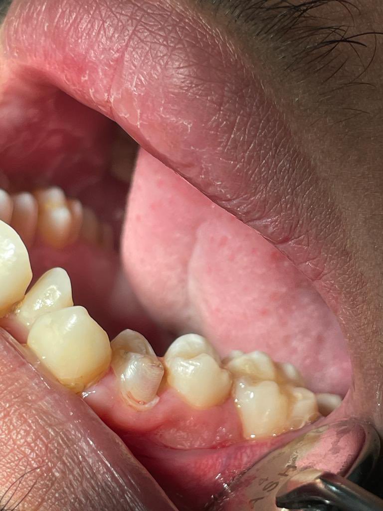 Dr.Raed Alasmari tweet media
