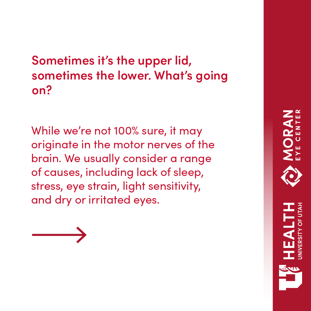 MoranEyeCenter's tweet image. What can you do to make an eye twitch go away? We're sharing helpful tips in our latest Healthfeed blog. bit.ly/3sRGolx