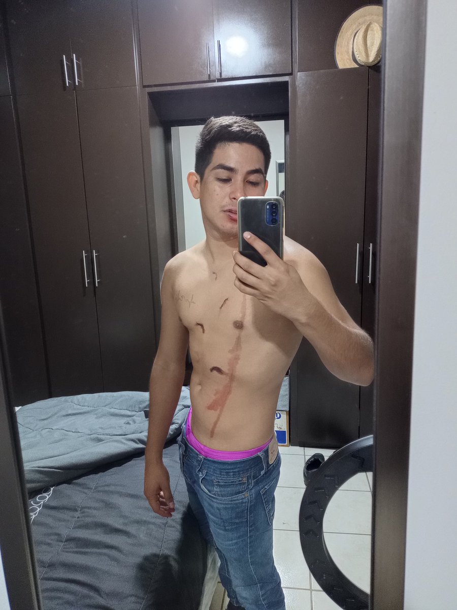 Si no suma, que no reste 🪦