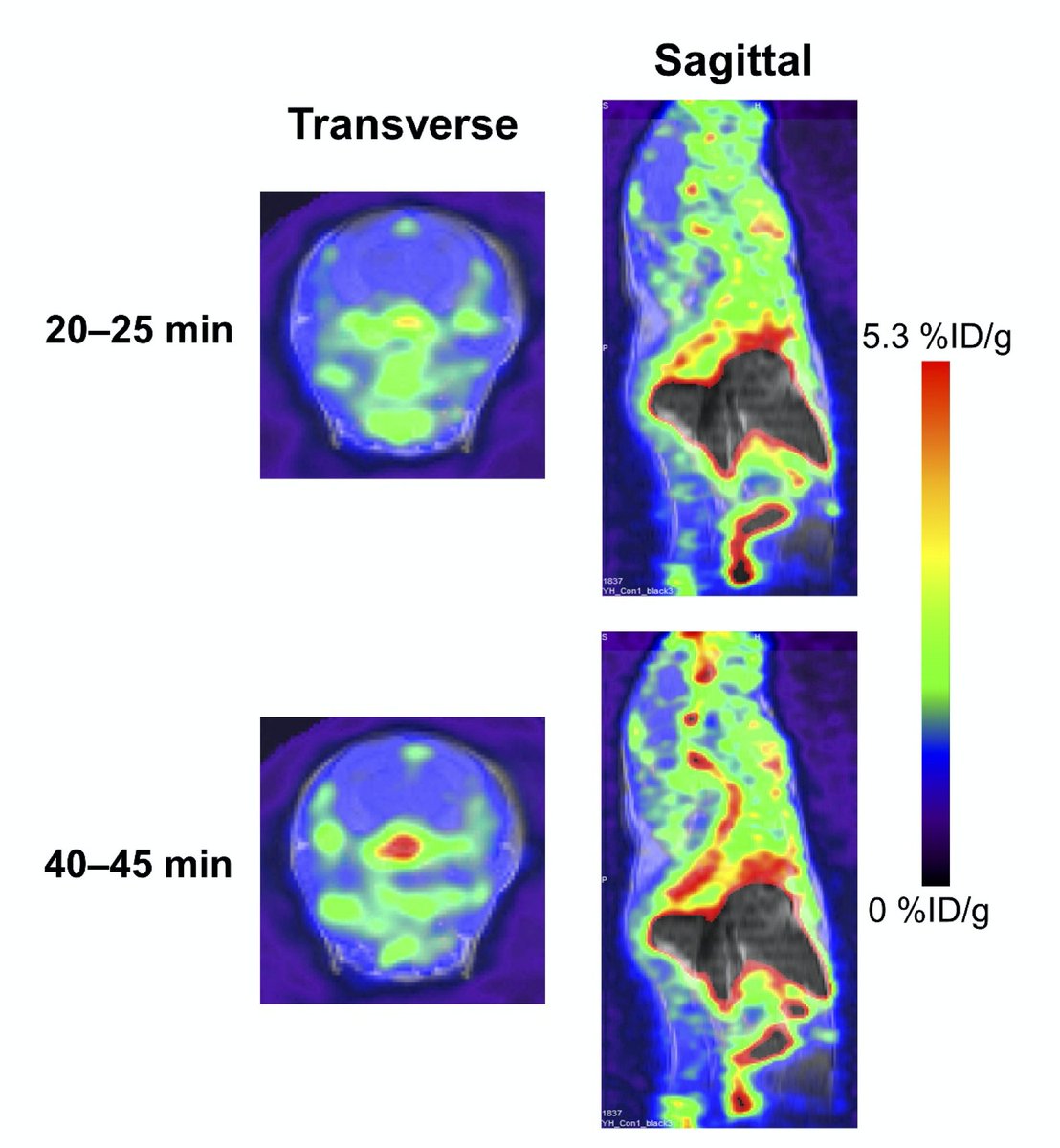Yassine Lab (@yassinelab1) on Twitter photo Can we image brain lipid inflammation associated with APOE4 Alzheimer's? Collaboration with Kai Chen from the Department of Radiology, <a href="/KECKSchool_USC/">Keck School of Medicine of USC</a>, 18-F AA synthesis and PET imaging led by Juno Van Valkenburgh and Marlon Duro, now published in PLEFA: sciencedirect.com/science/articl… Can we image brain lipid inflammation associated with APOE4 Alzheimer's? Collaboration with Kai Chen from the Department of Radiology, <a href="/KECKSchool_USC/">Keck School of Medicine of USC</a>, 18-F AA synthesis and PET imaging led by Juno Van Valkenburgh and Marlon Duro, now published in PLEFA: sciencedirect.com/science/articl…