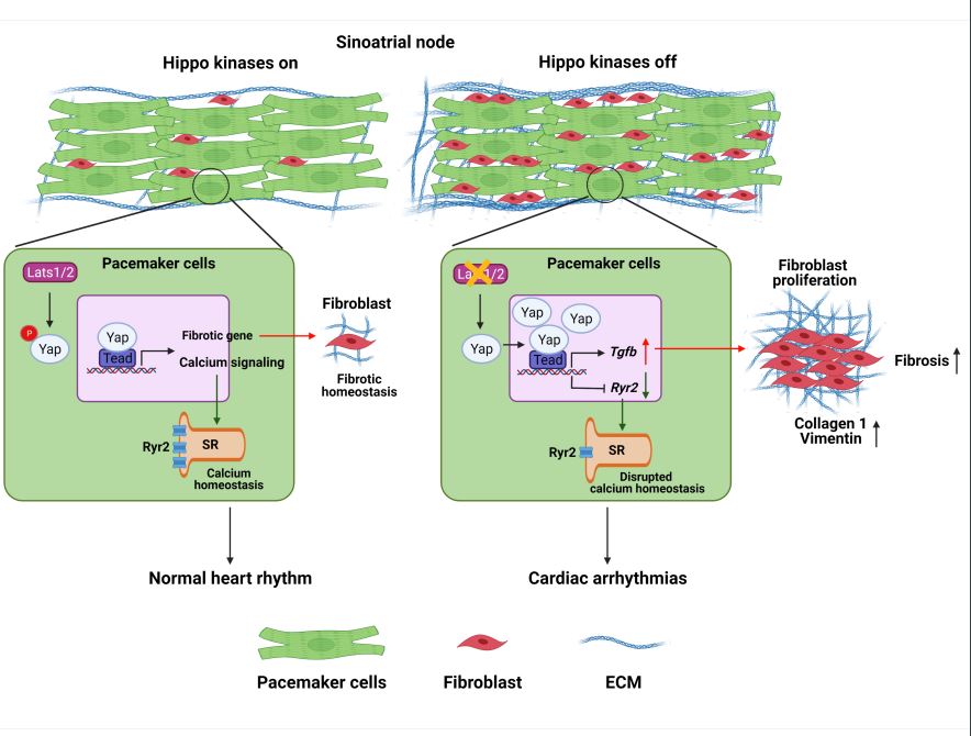 #OriginalResearch The Hippo signaling pathway may be an important regulation of normal sinoatrial node function <a href="/naliphd/">Na Li</a> <a href="/RichGangLi/">Rich Gang Li</a> #AHAJournals ahajrnls.org/3T5yqzU