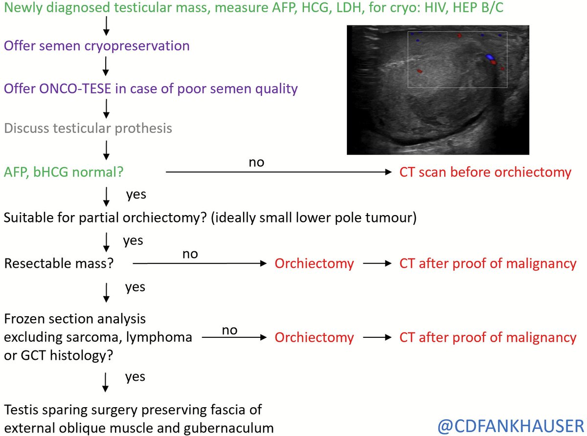 Christian D. Fankhauser (@cdfankhauser) on Twitter photo how a simple institutional work-flow
saved a young man from an unnecessary
orchiectomy and ionizing radiation of a CT scan
<a href="/AdityaBagrodia/">DrBagrodia</a> <a href="/siadaneshmand/">Sia Daneshmand, M.D.</a> <a href="/AmirSalmasi/">Amir Salmasi</a> <a href="/Hoomandjaladat/">Dr. Hooman Djaladat</a> <a href="/Dr_Andrology/">Prof Asif Muneer</a> <a href="/MaartenAlbersen/">Maarten Albersen</a> <a href="/RichMatulewicz/">Rich Matulewicz</a> <a href="/Silke_Gillessen/">silke gillessen</a> <a href="/OingC1/">Christoph_Oing</a> <a href="/ArieUrology/">Arie Parnham</a> how a simple institutional work-flow
saved a young man from an unnecessary
orchiectomy and ionizing radiation of a CT scan
<a href="/AdityaBagrodia/">DrBagrodia</a> <a href="/siadaneshmand/">Sia Daneshmand, M.D.</a> <a href="/AmirSalmasi/">Amir Salmasi</a> <a href="/Hoomandjaladat/">Dr. Hooman Djaladat</a> <a href="/Dr_Andrology/">Prof Asif Muneer</a> <a href="/MaartenAlbersen/">Maarten Albersen</a> <a href="/RichMatulewicz/">Rich Matulewicz</a> <a href="/Silke_Gillessen/">silke gillessen</a> <a href="/OingC1/">Christoph_Oing</a> <a href="/ArieUrology/">Arie Parnham</a>