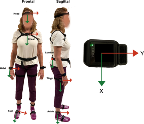 Stanford Neurology & Neurological Sciences (@stanford_neuro) on Twitter photo Researchers at Stanford, led by Helen Bronte-Stewart <a href="/HBSlab/">Bronte-Stewart Lab</a> & Scott Delp <a href="/StanfordNMBL/">Neuromuscular Biomechanics Lab at Stanford</a>, assessed wearable devices that people with #PD can wear based on Freezing of Gait detection performance & patient preferences. They discussed their findings: cheme.stanford.edu/freezing-gait-… Researchers at Stanford, led by Helen Bronte-Stewart <a href="/HBSlab/">Bronte-Stewart Lab</a> & Scott Delp <a href="/StanfordNMBL/">Neuromuscular Biomechanics Lab at Stanford</a>, assessed wearable devices that people with #PD can wear based on Freezing of Gait detection performance & patient preferences. They discussed their findings: cheme.stanford.edu/freezing-gait-…