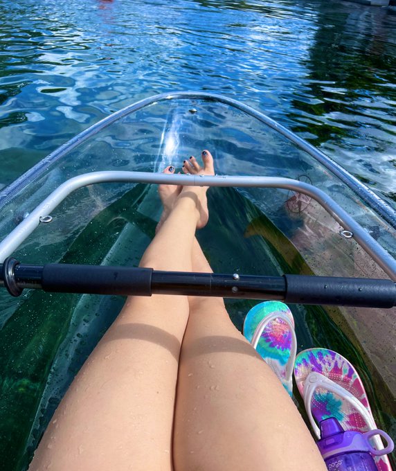 Like the view? https://t.co/0uqOkBugJ3<a href="/tag/freckles"class="tags"><span>#freckles</span></a>