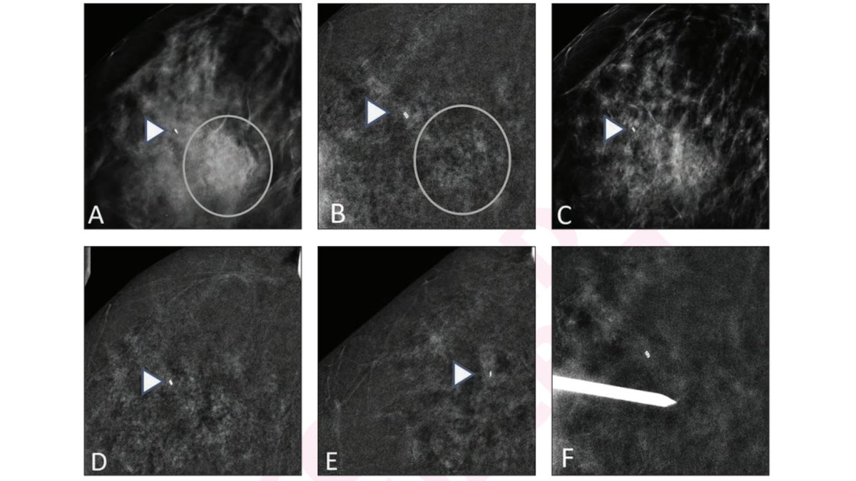 Andrew Rosenkrantz tweet media