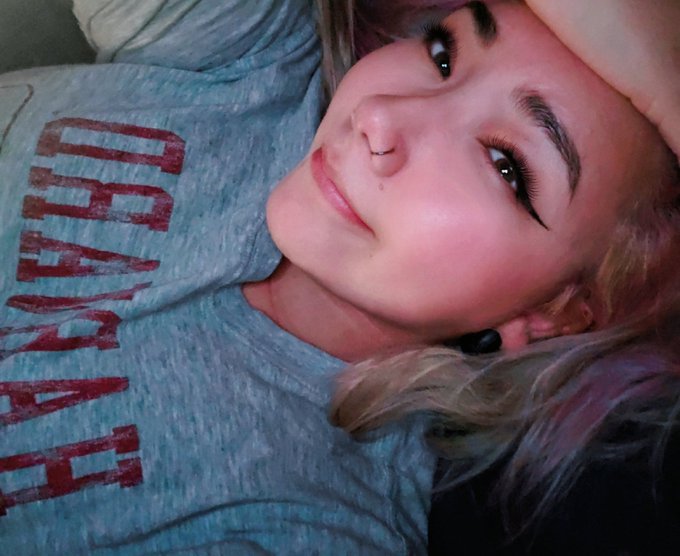 I bleached my hair and burned my scalp and also my hair is now 5 different colors It's giving mentally