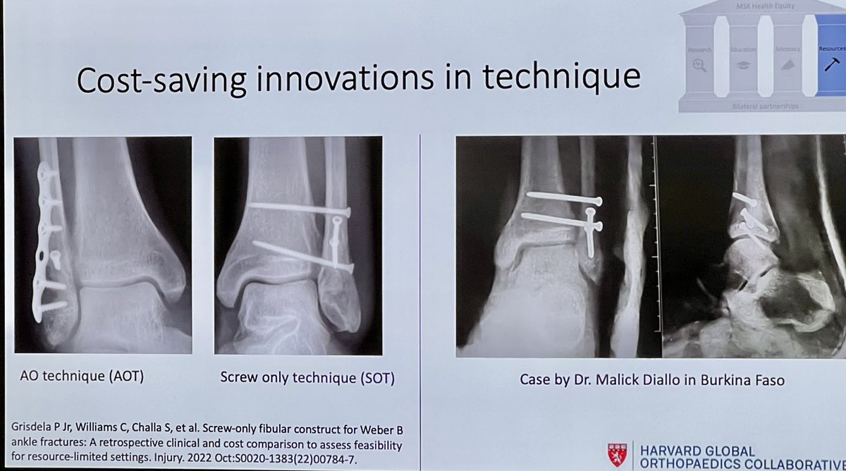 Outstanding talk <a href="/HarvardPGSSC/">Harvard Global Surgery</a> by <a href="/KiranHarding/">Kiran Agarwal-Harding</a> <a href="/OrthoGlobal/">Harvard Global Orthopaedics Collaborative</a> <a href="/BIDMChealth/">BIDMC</a> on #GlobalOrthopedics. Incredible progress on research, advocacy, education, and innovation👏👏👏.