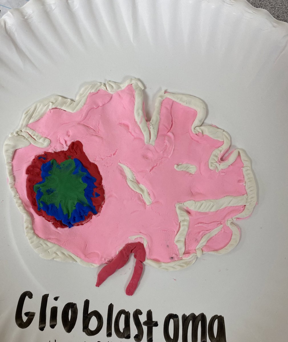 Students used modeling clay to better understand conditions affecting the brain and spinal cord. <a href="/jcityTNschools/">JohnsonCitySchools</a>  <a href="/ScienceHill_JCS/">SCIENCE HILL HIGH SCHOOL</a>