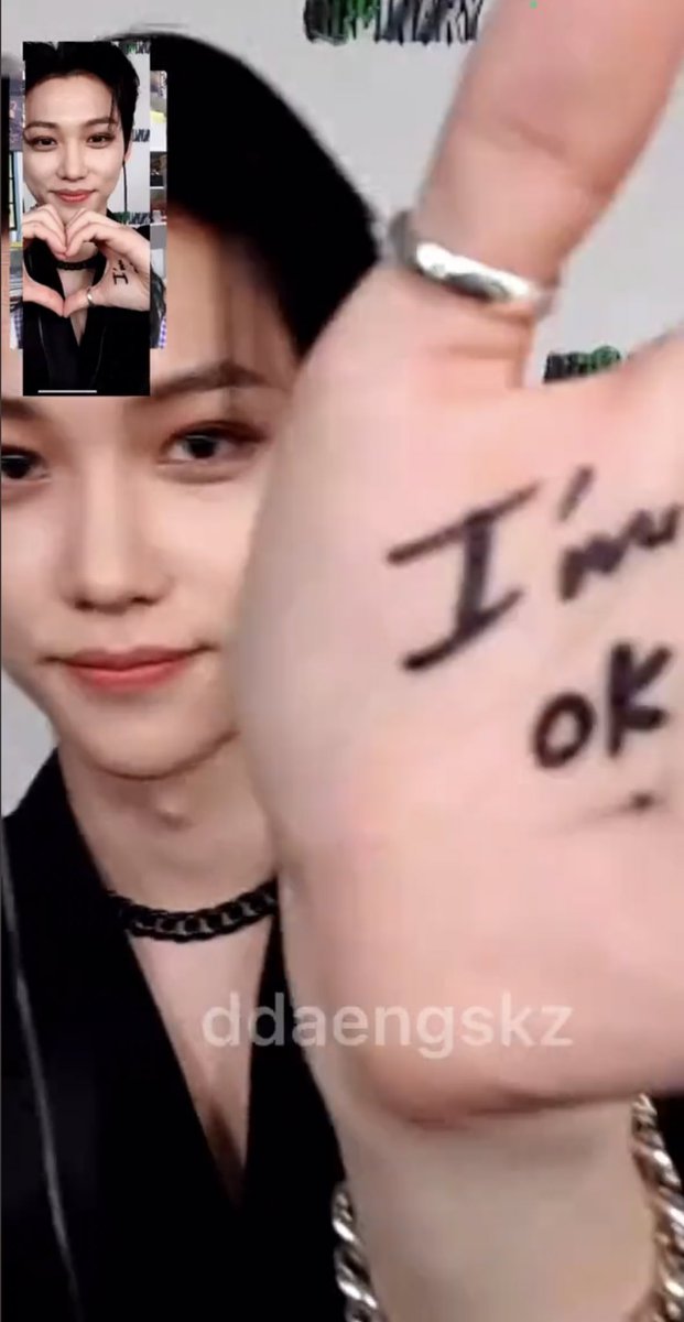 lixnotized's tweet photo. remember that one felix vc when there was technical issues and op couldn’t hear him at all and when op asked if his back was still hurting he wrote “i’m ok” on his hand ☹️ https://t.co/VCjtsdFw5X