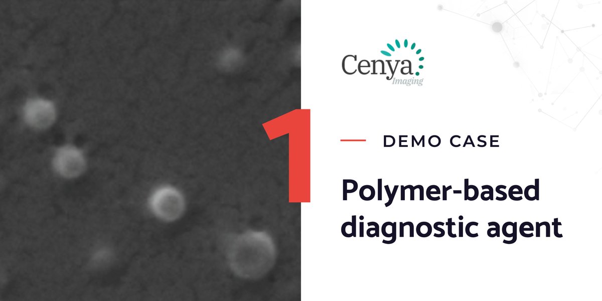 phoenixoitb's tweet photo. Partner Cenya Imaging ๐ณ๐ฑ produces imaging agents (BEACONS) that work across imaging modalities โ they can be used for quantitative, non-radioactive cell tracking in (pre)clinical settings.
โก๏ธFind out more here: https://t.co/V8t6XkGn8A
#democase #phoenixoitb #oitb https://t.co/e8H4UBoRDh