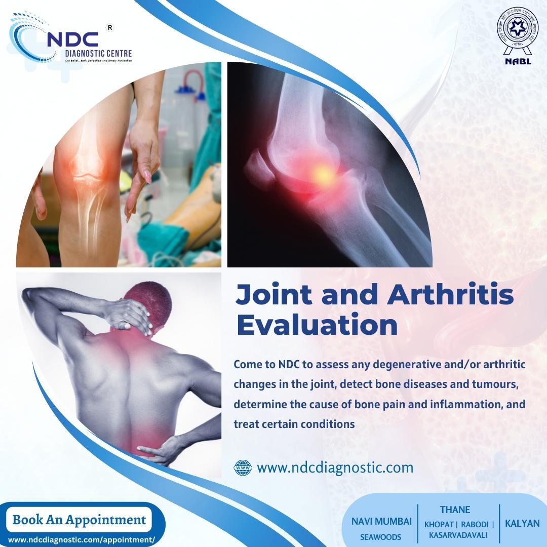 DiagnosticNdc's tweet photo. Get the Joint and Arthritis test done today and Safeguard your future!!

We run a 24-hour lab that offers prompt reports from time to time! ⚡

🔗 Visit us: https://t.co/eJ8EFukJP8

#ndcdiagnostic #health #proteintest #ArthritisEvaluation #jointevaluation #joint #arthritis https://t.co/qvzQqk6ykB