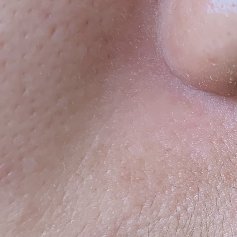 linskinjournal's tweet photo. kulit bersih mulus itu banyak caranya, SALAH SATUnya ya rajin EXFOLIASI. jangan males exfo ya gurls!๐ซถ๐ป
#gentleskincare #exfotoner https://t.co/PhjFxiMb3A