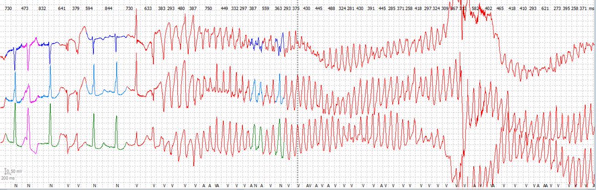 Cardio-Primaria Ferrol tweet media