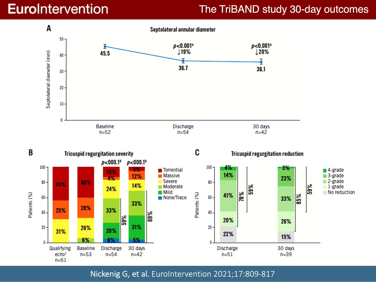 EuroInterventio's tweet photo. In this study of patients with functional #tricuspid regurgitation, the #Cardioband tricuspid system demonstrated significant efficacy through annular reduction, along with early evidence of right heart remodelling. #EAPCI  https://t.co/v5M1Od5gKO https://t.co/tkw2ZYdgRj