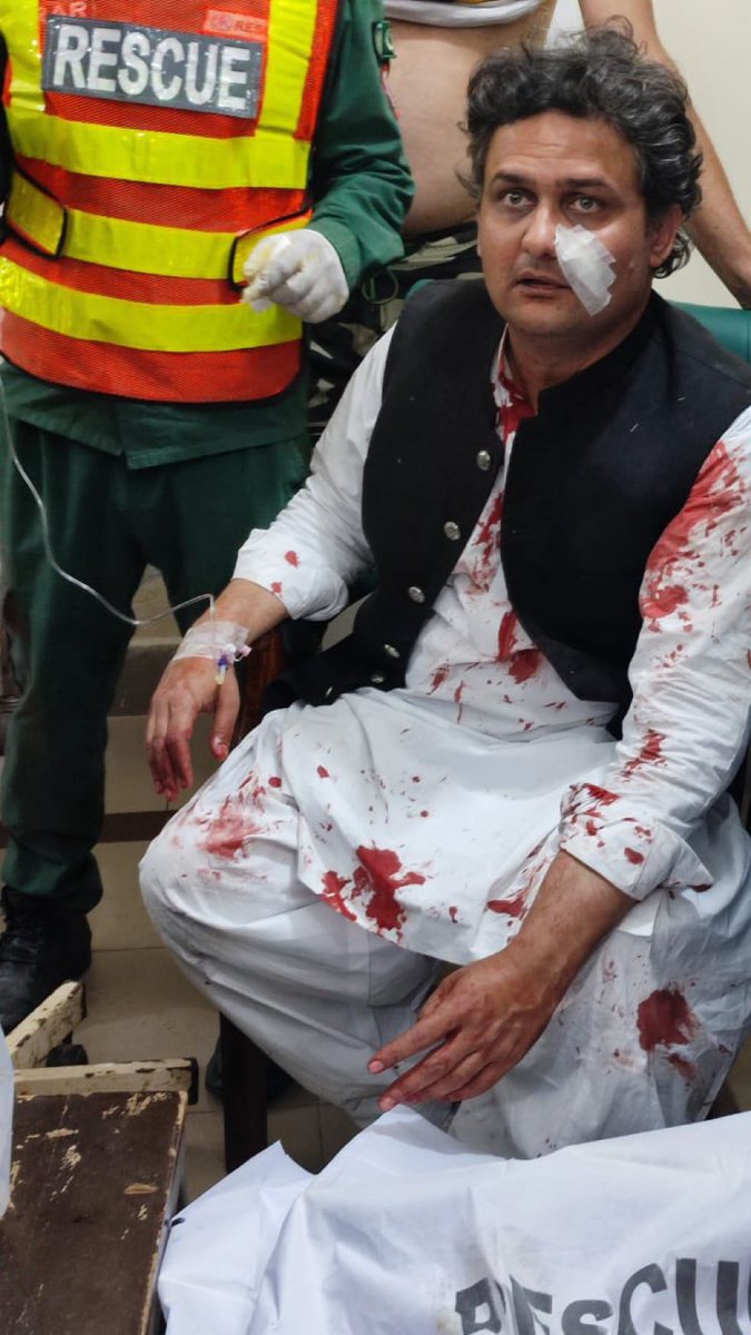 iihtishamm's tweet photo. Faisal Javed is Injured. https://t.co/b5xhEbAEes