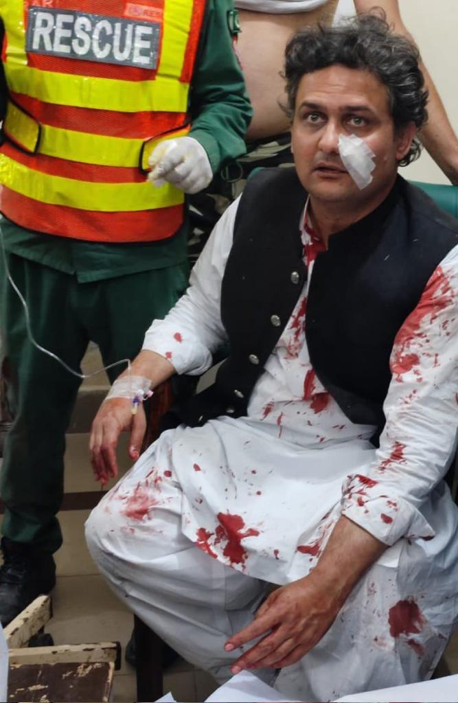 Malok_Shoujaat's tweet photo. #FaisalJavedKhan is also injured during the firing attack on containers.

#ImranKhan | #Wazirabad | #Firing https://t.co/g9d5gAeJJl