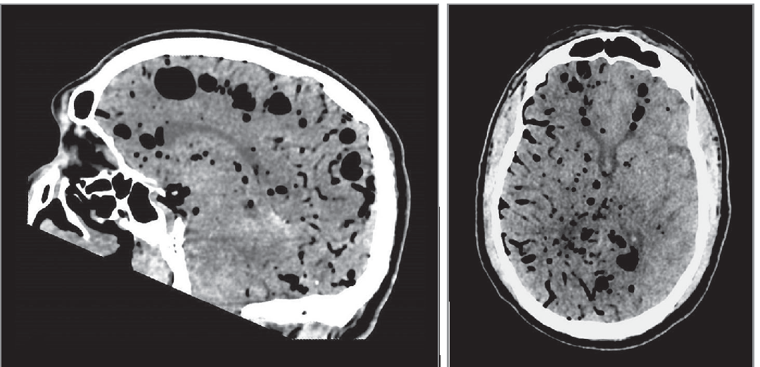 Oren Gottfried, MD tweet media