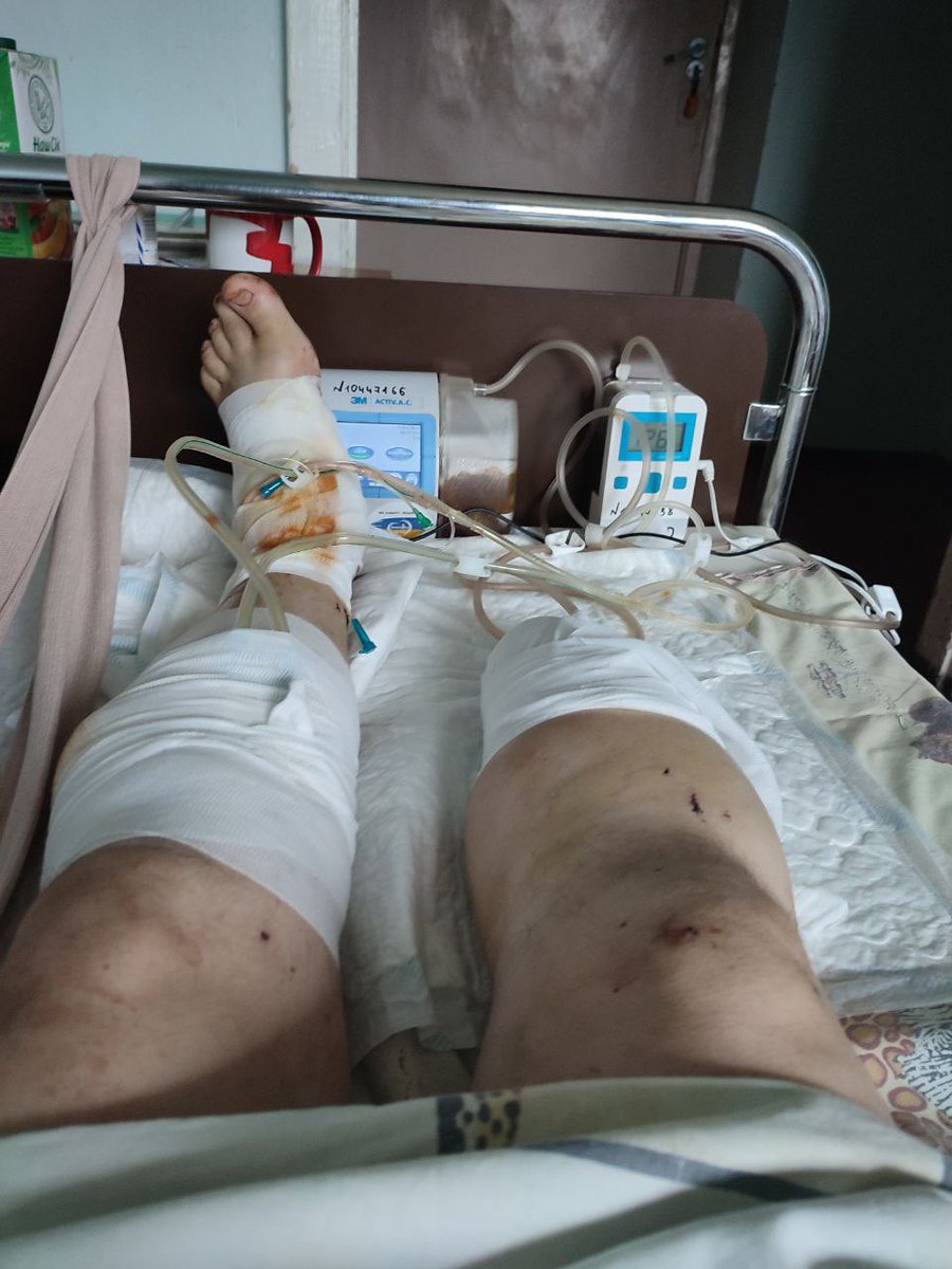 RuslanDudenko's tweet photo. На зло ворогу, буду жити!!! https://t.co/Yr0Wfaa58w