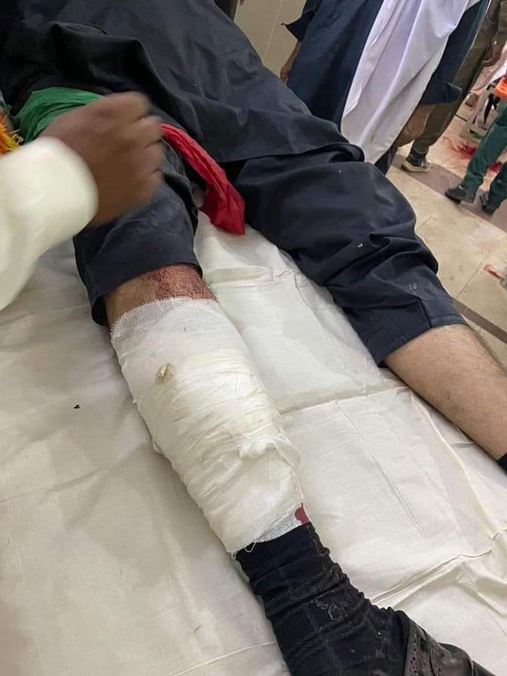 PeaceForALL_1st's tweet photo. Highly condemn the attack on @ImranKhanPTI. My prayers for the health and speedy recovery of all the injured people and deceased. May Allah SWT protect Pakistan, Ameen.
#ImranKhan https://t.co/NPj4lEus3p