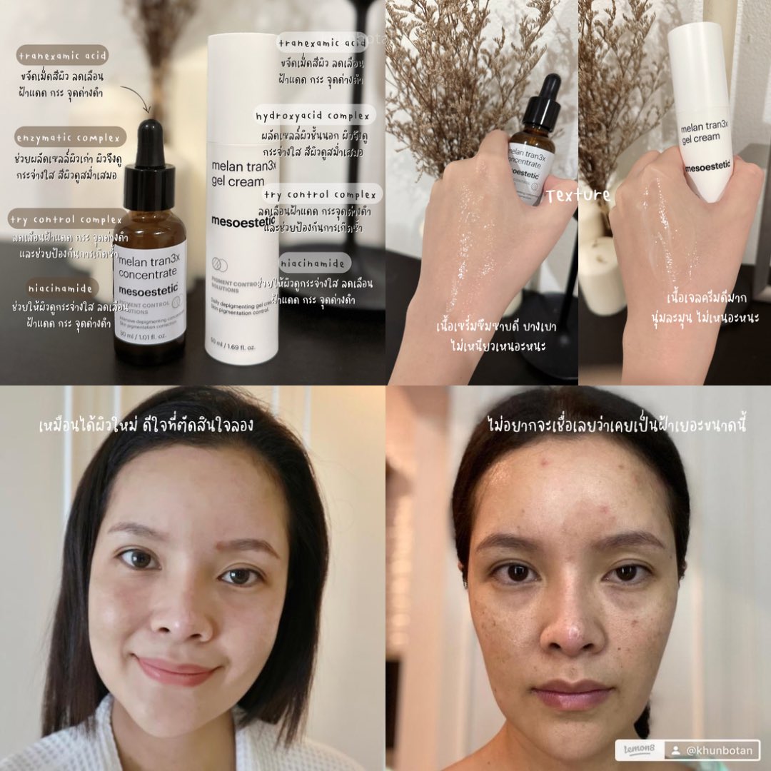 นี่คือไอเทมลดฝ้าที่โบตั๋นภูมิใจนำเสนอจริงๆ #mesoestetic melan tran3x ต้องขอบคุณเพื่อนๆ ที่ช่วยกันป้ายยาจนทำให้เราไม่พลาดของดีขนาดนี้ ฝ้าแดด กระ จุดด่างดำจาง ผิวกระจ่างใสขึ้นเหมือนตายแล้วเกิดใหม่😆 

#khunbotanreview #ไว้รีวิวห้ามขายของโว้ยย #ของมันต้องมี