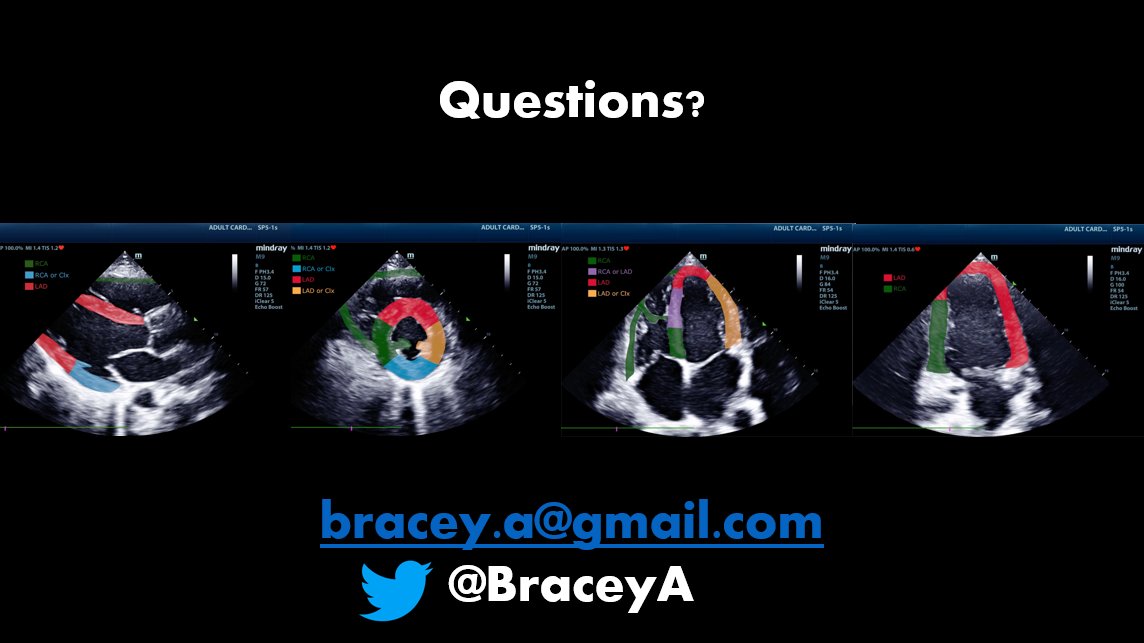 Thank you again to all who attended my talk on wall motion abnormalities in #OMI at #ResusX2022 and to <a href="/CriticalCareNow/">Haney Mallemat</a> and <a href="/resus_x/">ResusX</a> for the opportunity!