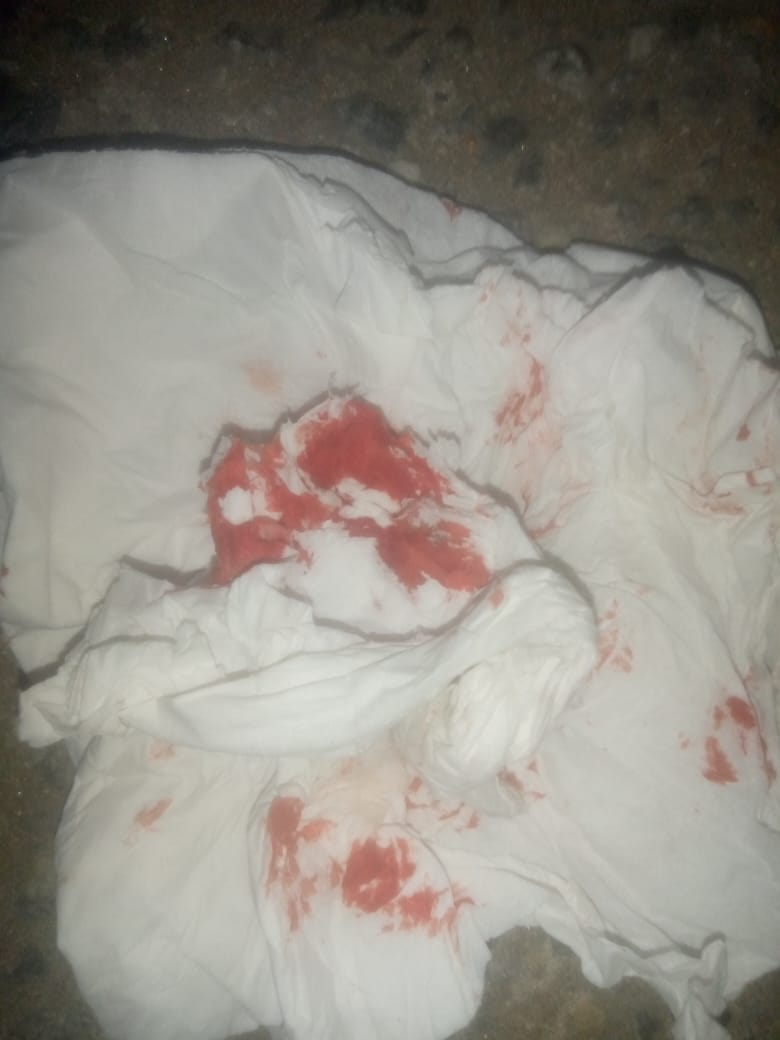 LAWYERTUNDE's tweet photo. @BenHundeyin @MobilePunch @BenHundeyin what did you do about the case of a man your officers at a check point around Opebi assaulted? I instructed him to report the incident at Area F command, Ikeja Division which he did but there no follow up thereafter. 

I personally demanded for update but nothing ... https://t.co/olb9i8zdQc