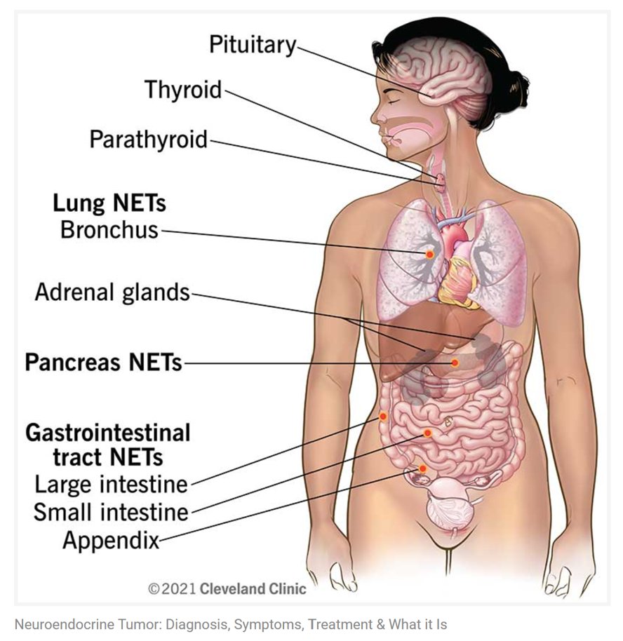 CarcinoidNETs tweet picture
