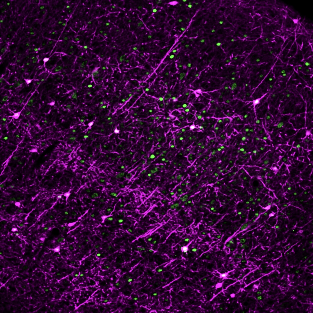 dev_neuro's tweet photo. What a pic from @mjcondus one of our internal seminar speakers! What is different between a brain that has been exposed to extra sensory stimulation early in life and one that has not? Here we see brain cells active early in life (magenta) and those that are active later (green). https://t.co/jfHV7DznPD