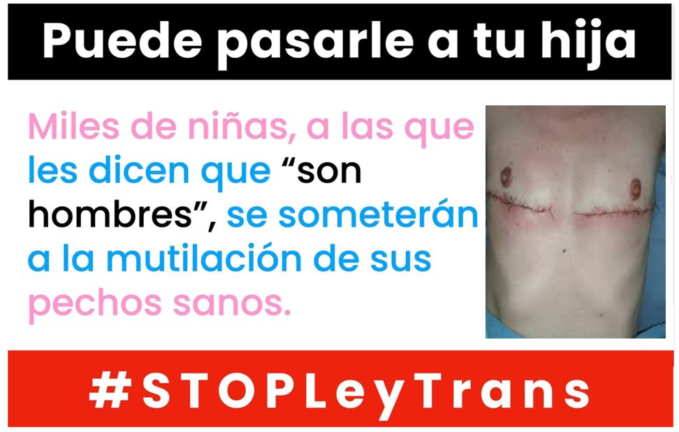 Otvale1's tweet photo. Si se aprobara la Pena de Muerte a sabiendas de que se pueda condenar a muchas personas inocentes, sería un escándalo y una aberración.
Eso va a pasar con la Ley Trans. Saben las cifras escandalosas de adolescentes con Disforia de Género de Inicio Rápido y aún así, les da igual. https://t.co/payQsBoZHy