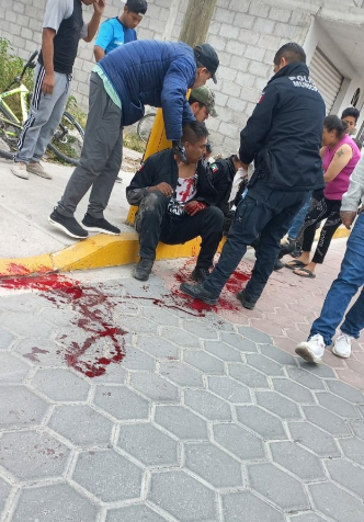 GalileoMx_'s tweet photo. #Ahora| Elementos policiales de #Tecamachalco fueron heridos de bala tras una persecución que tuvieron con sujetos desconocidos sobre la 15 Sur y 3 Poniente en el Barrio de San Sebastián #Puebla 🚔🚨
📸: @no_soy_elnahua https://t.co/80FzxolSs7