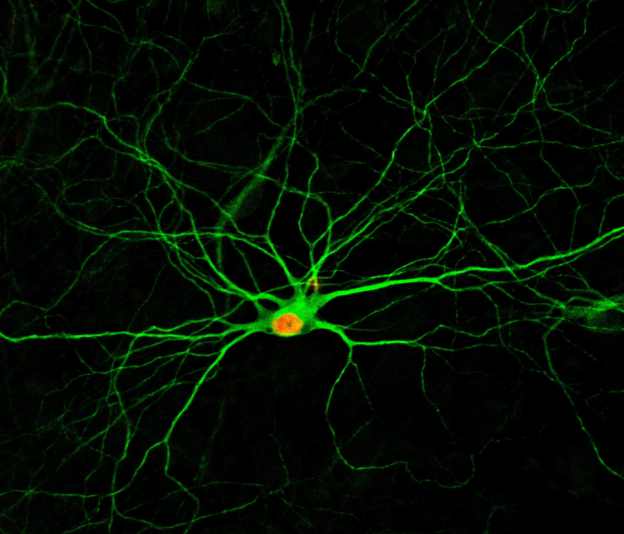 Is anyone working with human astrocytes recently? Located in Paris.