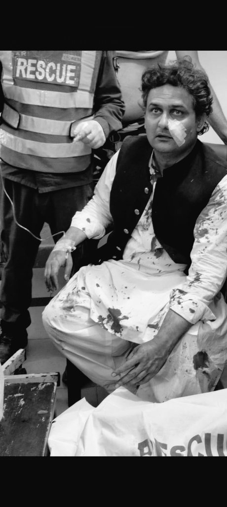 zyam_ii's tweet photo. Firing at Imran Khan's Container 💔 5 Injured including Imran Khan and One dead 😭 May allah rank him high in jannah #ImranKhan #PTIOfficial #LongMarch https://t.co/8v8AgHAQi9