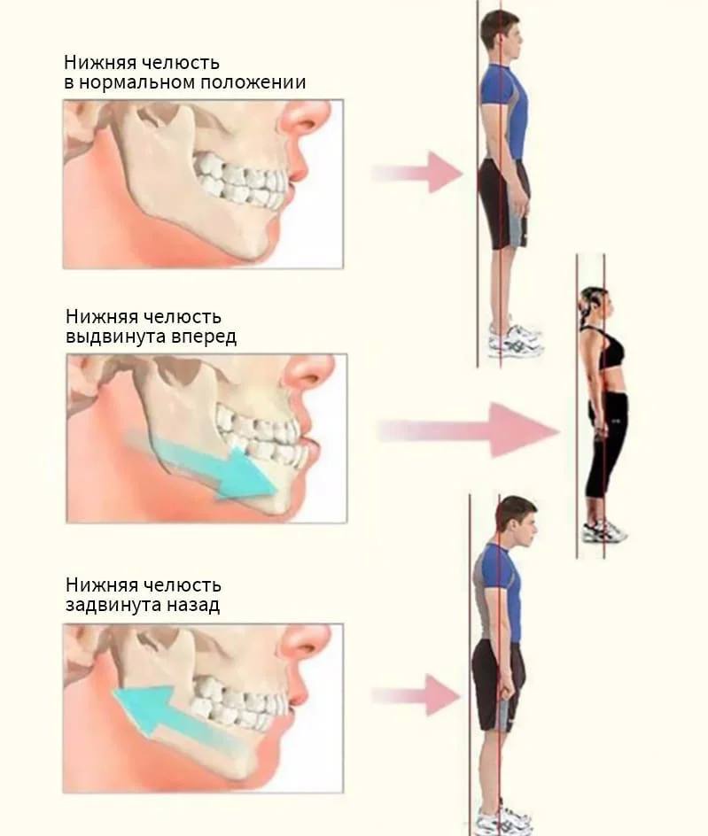 SECRETS OF THE BITE 👄

facebook.com/tatjana.nikole…

# cst_osteo_malocclusion
# cst_osteo_braces
# cst_osteo_poisture