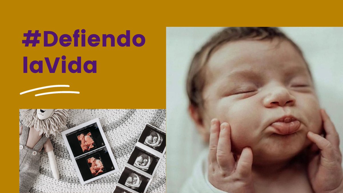 enrumbaorg's tweet photo. Nunca menospreciemos el valor que tienen los niños, aún para el Dios de los cielos son de gran aprecio

"Jesús les dijo: Sí, ¿nunca leísteis: De boca de niños y lactantes perfeccionaste la alabanza?" Mt. 21:16

#EnrumbaOrg #DecidoAmar #SialaVida #DefiendolaVida   #NoalAborto https://t.co/5pgjVOhed3